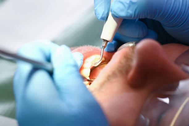 Best Emergency Care for Gum Disease in Ferndale, WA