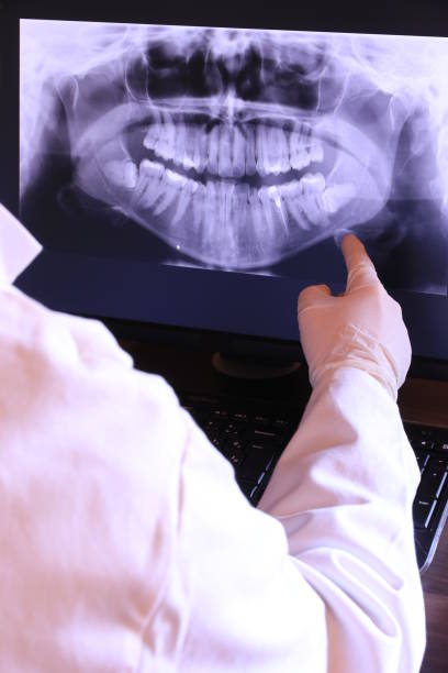 Best Emergency Treatment for Oral Infections in Ferndale, WA